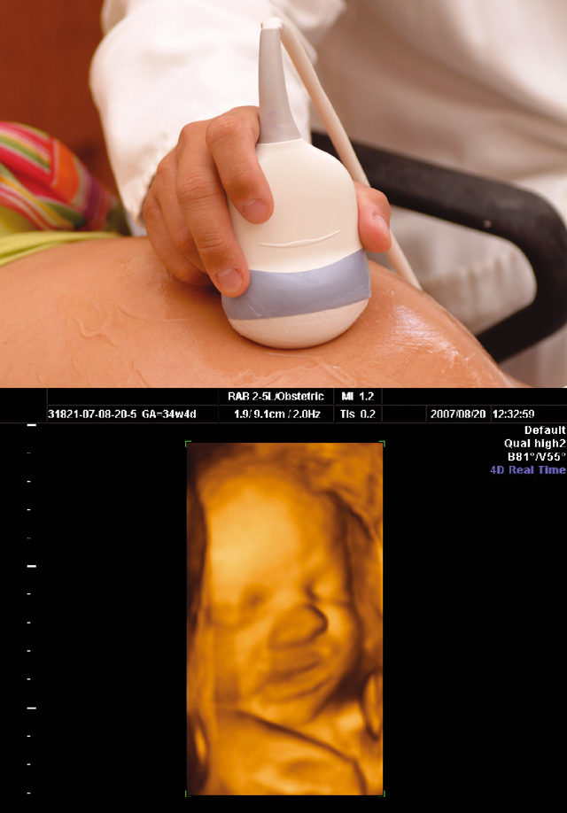 3D ultrahang vizsgálat